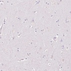 Immunohistochemical staining of human cerebral cortex shows low expression as expected.