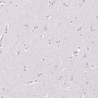 Immunohistochemical staining of human cerebral cortex shows low expression as expected.