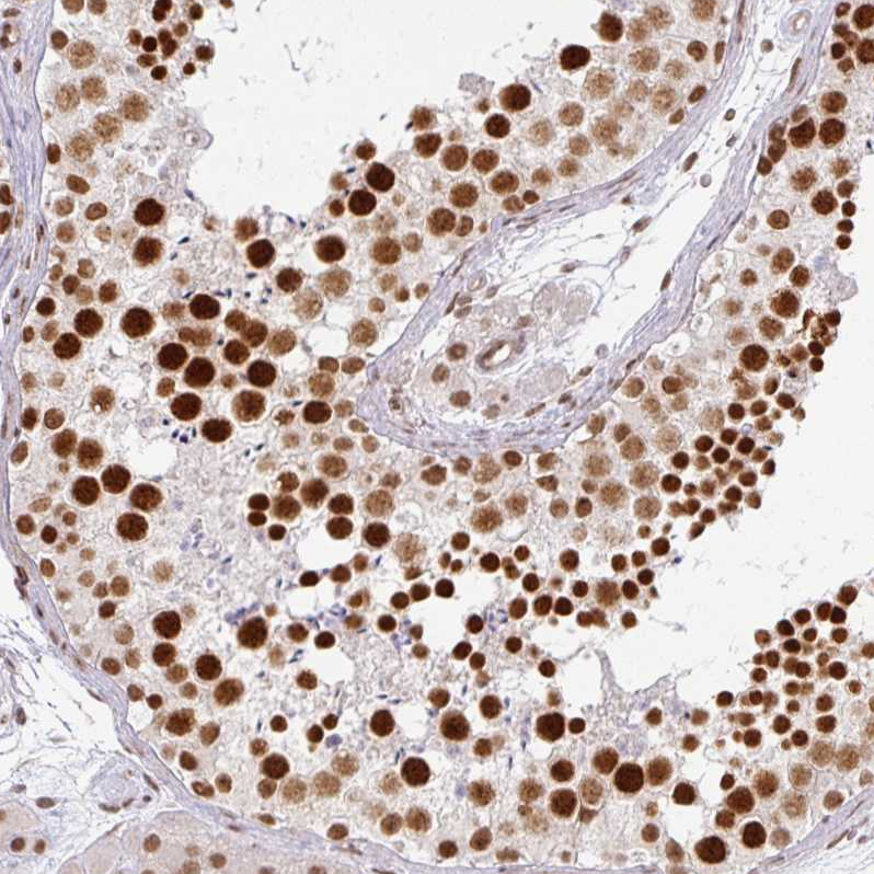 Anti-NCOA5 Antibody