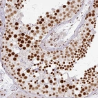 Anti-NCOA5 Antibody