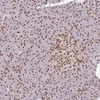 Immunohistochemical staining of human pancreas shows moderate nuclear positivity in islets of Langerhans and exocrine cells.