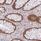 Immunohistochemical staining of human rectum shows strong nuclear positivity in glandular cells.