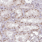 Immunohistochemical staining of human kidney shows moderate nuclear positivity in cells in tubules.