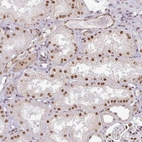 Immunohistochemical staining of human kidney shows moderate nuclear positivity in cells in tubules.