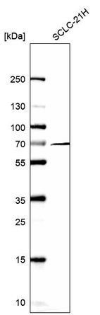 Western blot analysis in human cell line SCLC-21H.