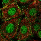 Immunofluorescent staining of human cell line MCF7 shows localization to nucleoplasm & actin filaments.