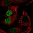 Anti-MORC4 Antibody