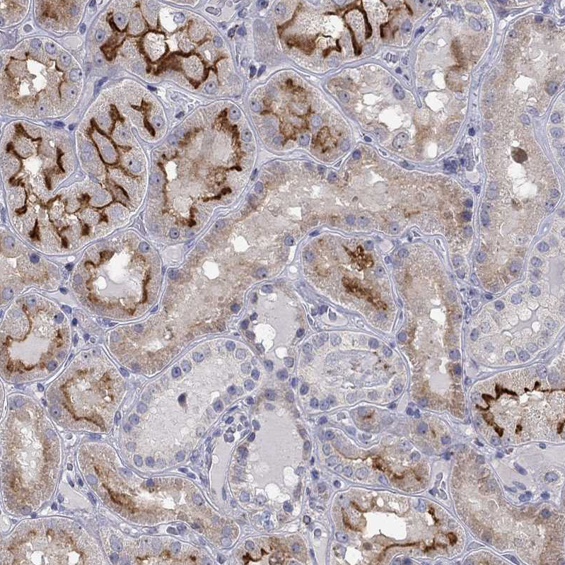 Anti-QRFPR Antibody