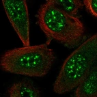 Immunofluorescent staining of human cell line PC-3 shows localization to nuclear speckles.