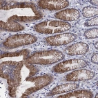 Immunohistochemical staining of human stomach shows strong membranous -cytoplasmic positivity in glandular cells.
