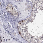 Immunohistochemical staining of human testis shows strong membranous-cytoplasmic positivity in subset of cells in seminiferous ducts.