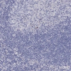 Immunohistochemical staining of human tonsil shows no positivity in non-germinal center cells and germinal center cells as expected.