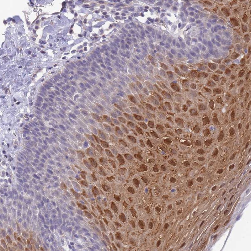 Anti-C19orf25 Antibody