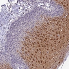 Anti-C19orf25 Antibody
