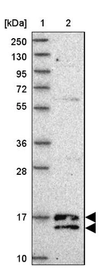 Lane 1: Marker [kDa] 250, 130, 95, 72, 55, 36, 28, 17, 10_br/_Lane 2: Human cell line RT-4