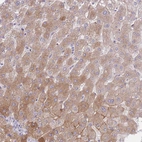 Anti-HRG Antibody