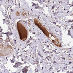 Immunohistochemical staining of human rectum shows strong positivity in plasma.
