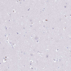 Immunohistochemical staining of human cerebral cortex shows no positivity in neurons as expected.