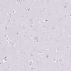 Immunohistochemical staining of human cerebral cortex shows no positivity in neurons as expected.