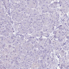 Immunohistochemical staining of human pancreas shows no positivity in exocrine glandular cells as expected.