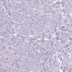 Immunohistochemical staining of human pancreas shows no positivity in exocrine glandular cells as expected.