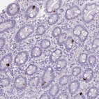 Anti-ZNF43 Antibody