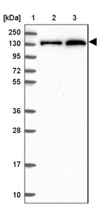 Lane 1: Marker [kDa] 250, 130, 95, 72, 55, 36, 28, 17, 10_br/_Lane 2: Human cell line RT-4_br/_Lane 3: Human cell line U-251MG sp