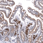 Immunohistochemical staining of human duodenum shows moderate cytoplasmic/cytoplasmic granular positivity in glandular cells.