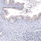 Immunohistochemical staining of human prostate shows weak cytoplasmic/cytoplasmic granular positivity in glandular cells.