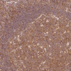 Anti-PDAP1 Antibody