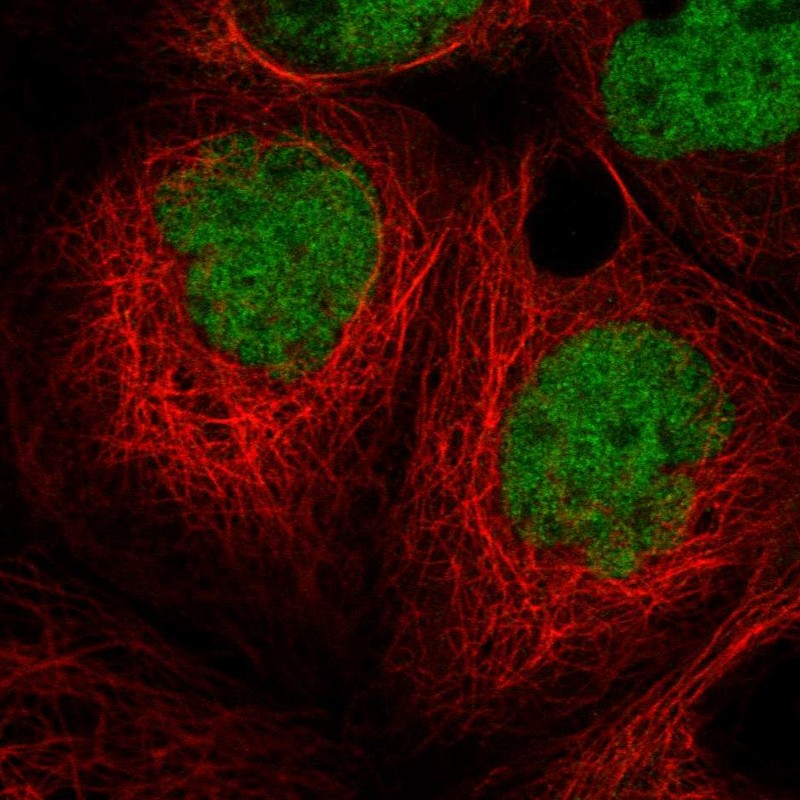 Anti-MIER1 Antibody