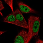 Anti-PGAM2 Antibody