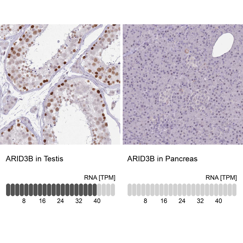 Anti-ARID3B Antibody