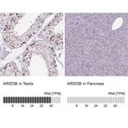 Anti-ARID3B Antibody