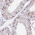 Immunohistochemical staining of human testis shows high expression.