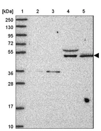 Lane 1: Marker [kDa] 250, 130, 95, 72, 55, 36, 28, 17, 10_br/_Lane 2: Human cell line RT-4_br/_Lane 3: Human cell line U-251MG sp_br/_Lane 4: Human plasma (IgG/HSA depleted)_br/_Lane 5: Human liver tissue