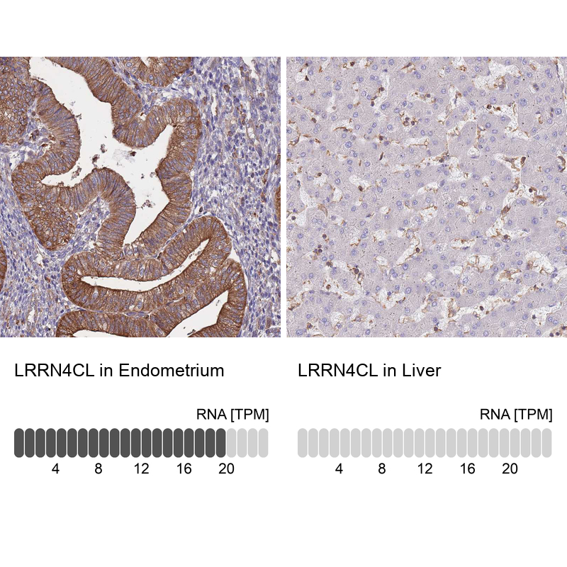 Anti-LRRN4CL Antibody