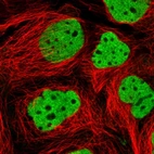 Immunofluorescent staining of human cell line CACO-2 shows localization to nucleoplasm.