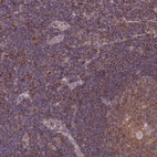 Immunohistochemical staining of human lymph node shows strong membranous positivity in non-germinal center cells and germinal center cells.