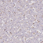 Immunohistochemical staining of human liver shows no positivity in hepatocytes as expected.