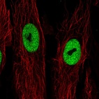 Immunofluorescent staining of human cell line BJ shows localization to nucleoplasm.