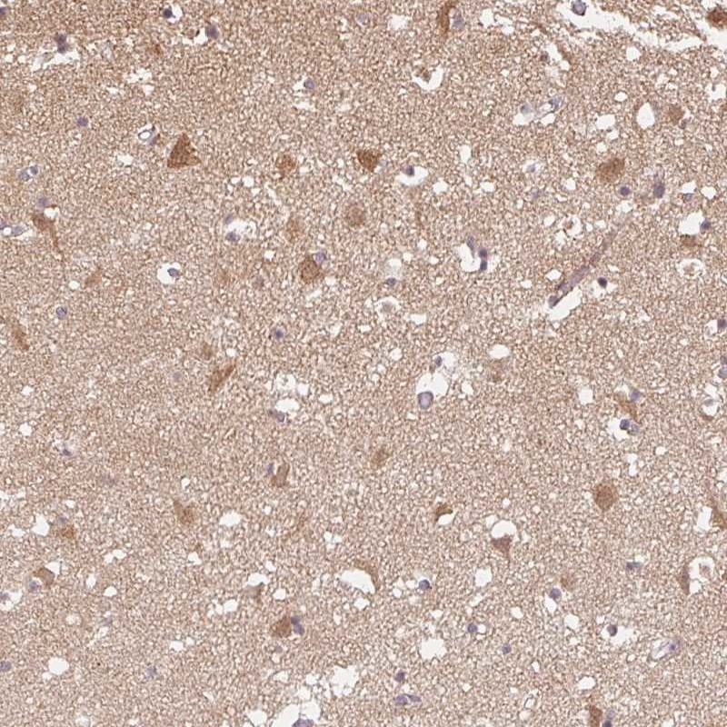 Anti-PPP4R4 Antibody