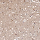 Anti-PPP4R4 Antibody