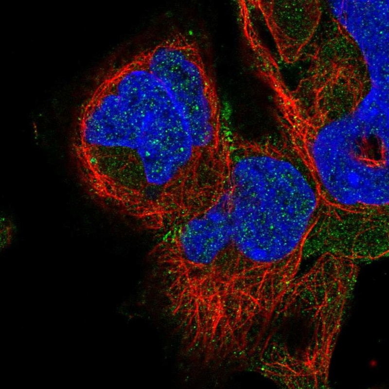 Anti-ADAM22 Antibody