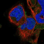 Anti-ADAM22 Antibody