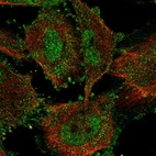 Immunofluorescent staining of human cell line U-251 MG shows localization to nucleoplasm & plasma membrane.