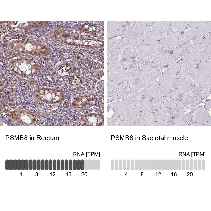 Anti-PSMB8 Antibody