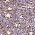 Immunohistochemical staining of human colon, kidney, liver and lymph node using Anti-PSMB8 antibody HPA050327 (A) shows similar protein distribution across tissues to independent antibody HPA046995 (B).