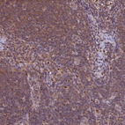 Immunohistochemical staining of human lymph node shows high expression.