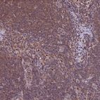 Immunohistochemical staining of human lymph node shows high expression.
